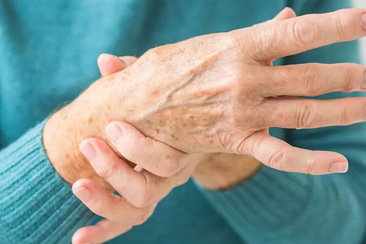 Carpel Tunnel Syndrome